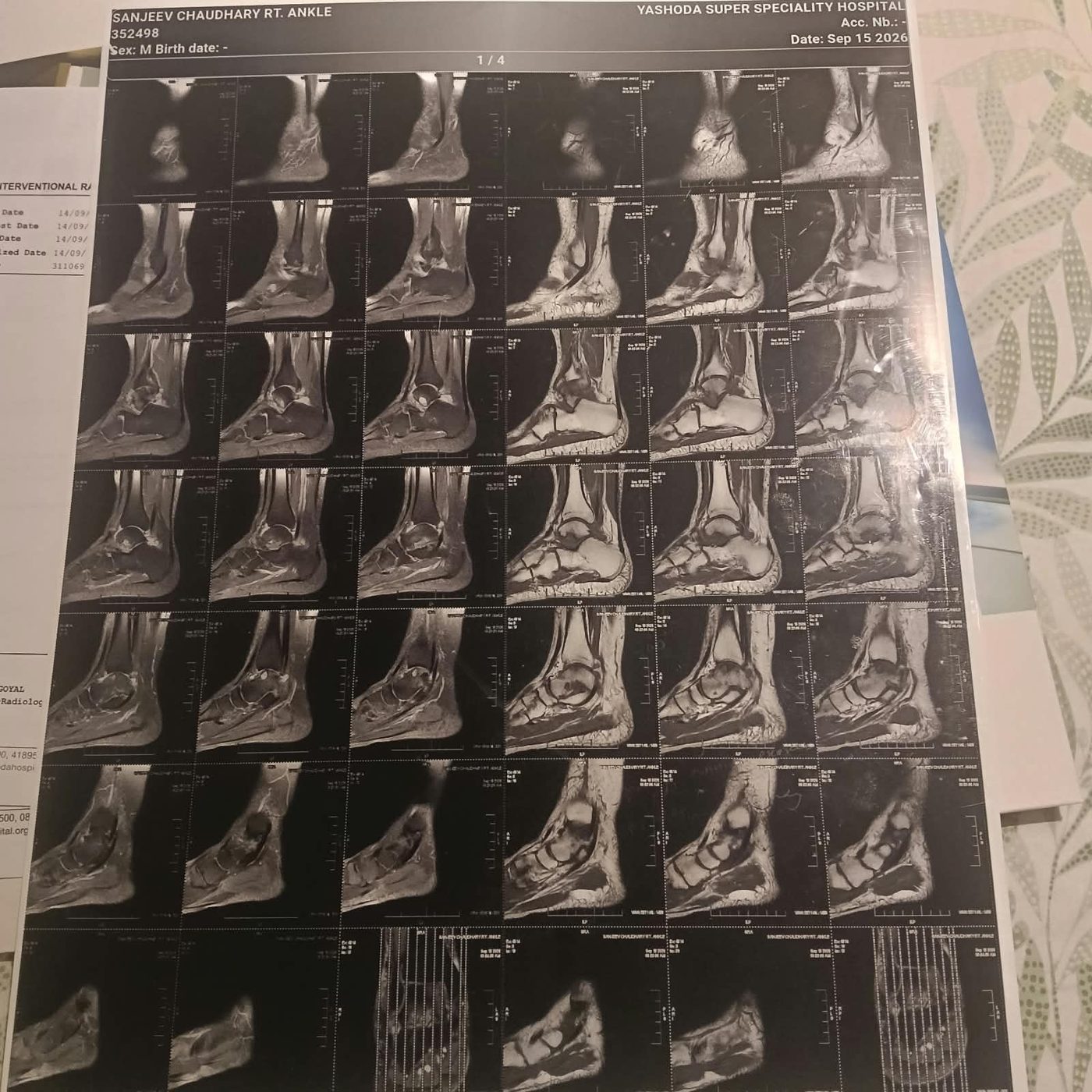 MRI film page 1 of 4 sagittal