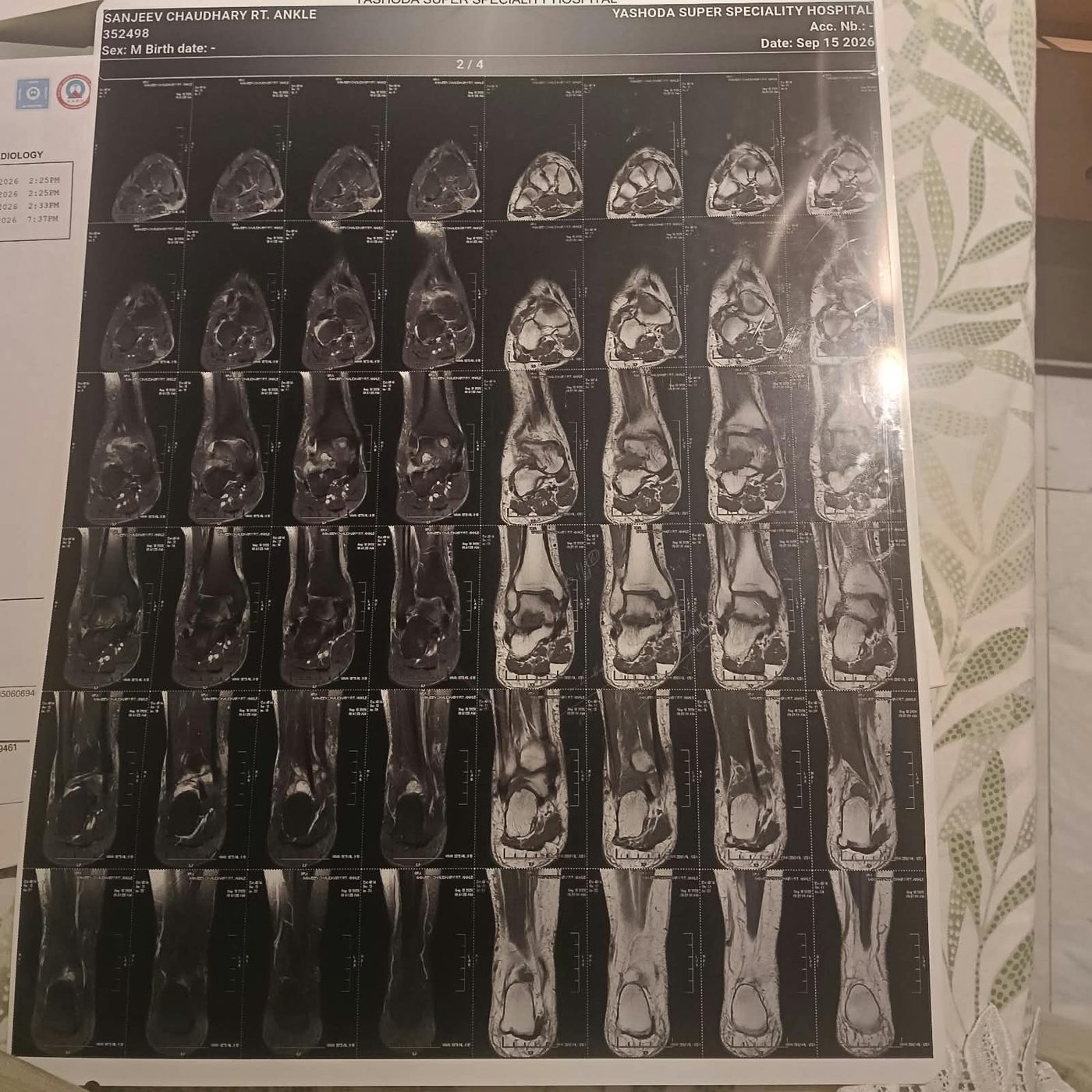MRI film page 2 of 4