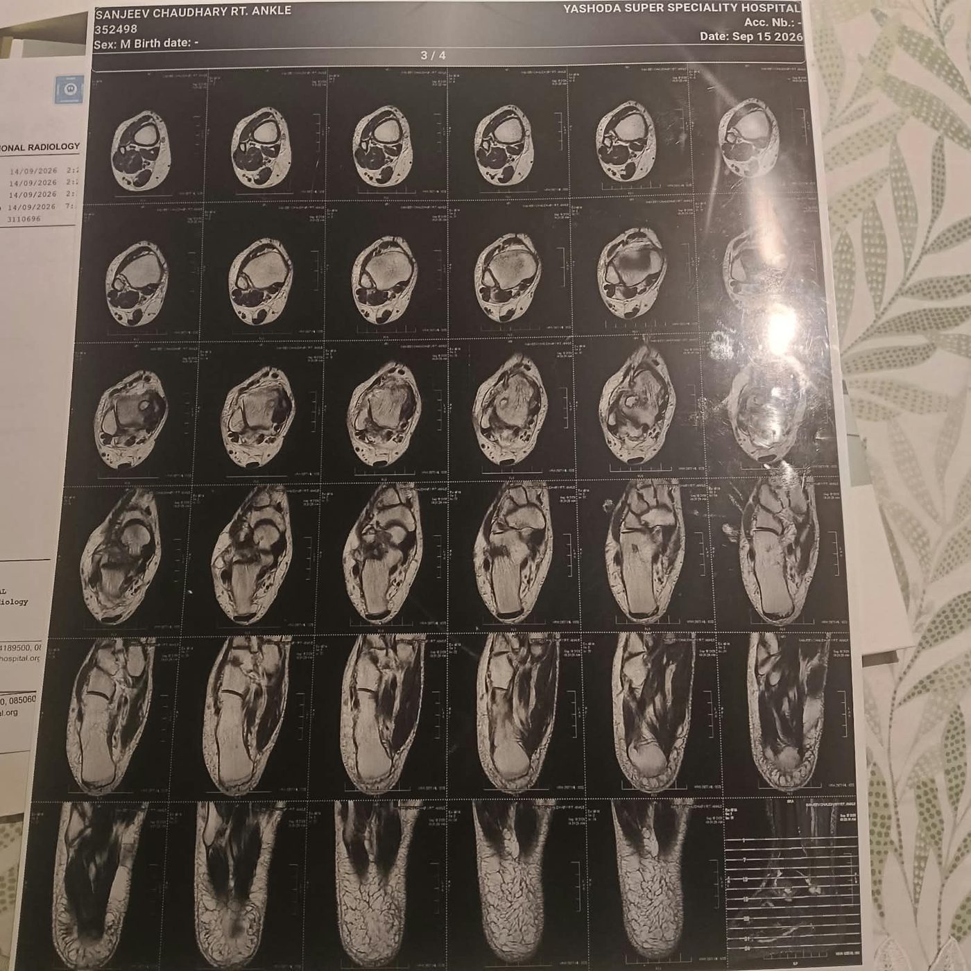 MRI film page 3 of 4 axial