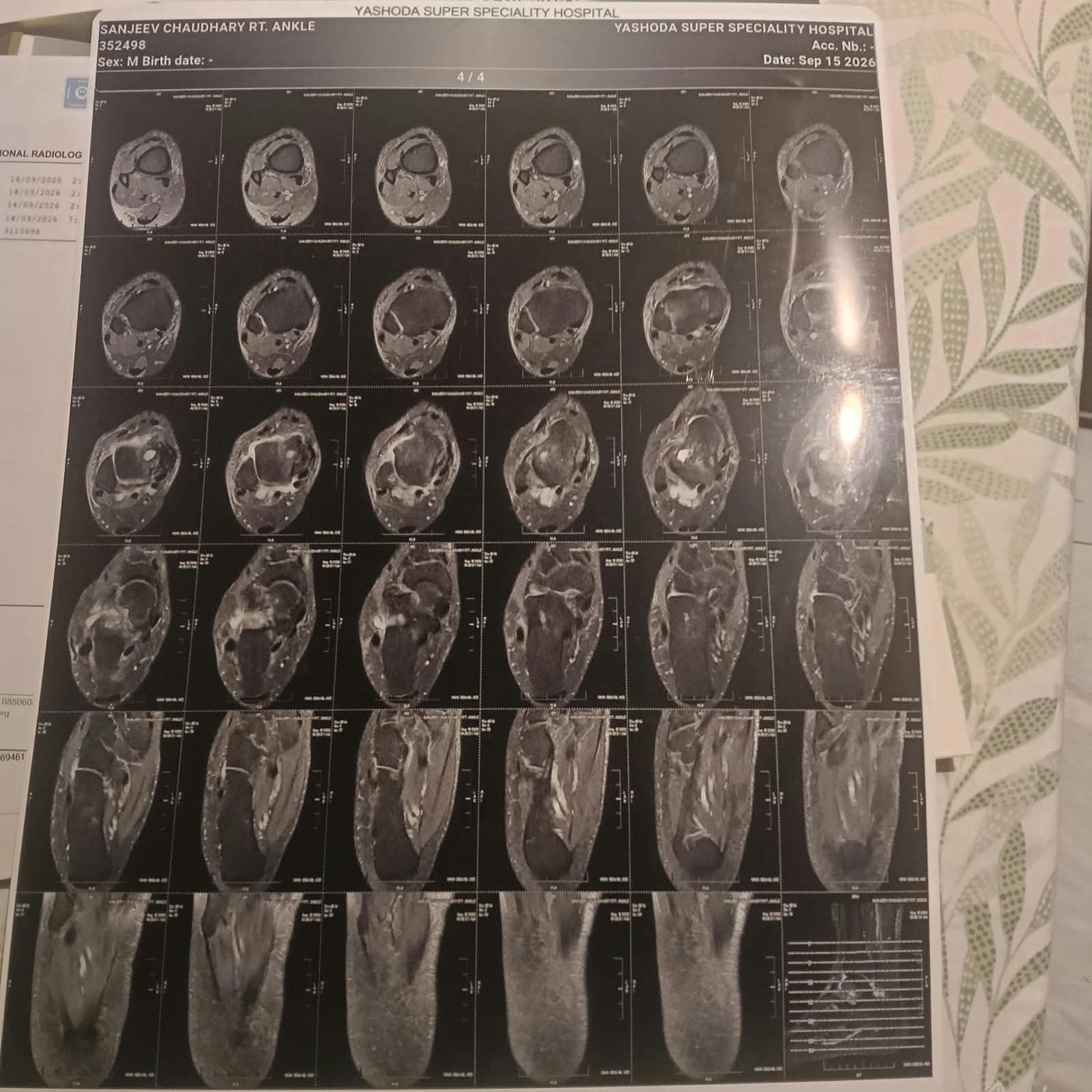 MRI film page 4 of 4