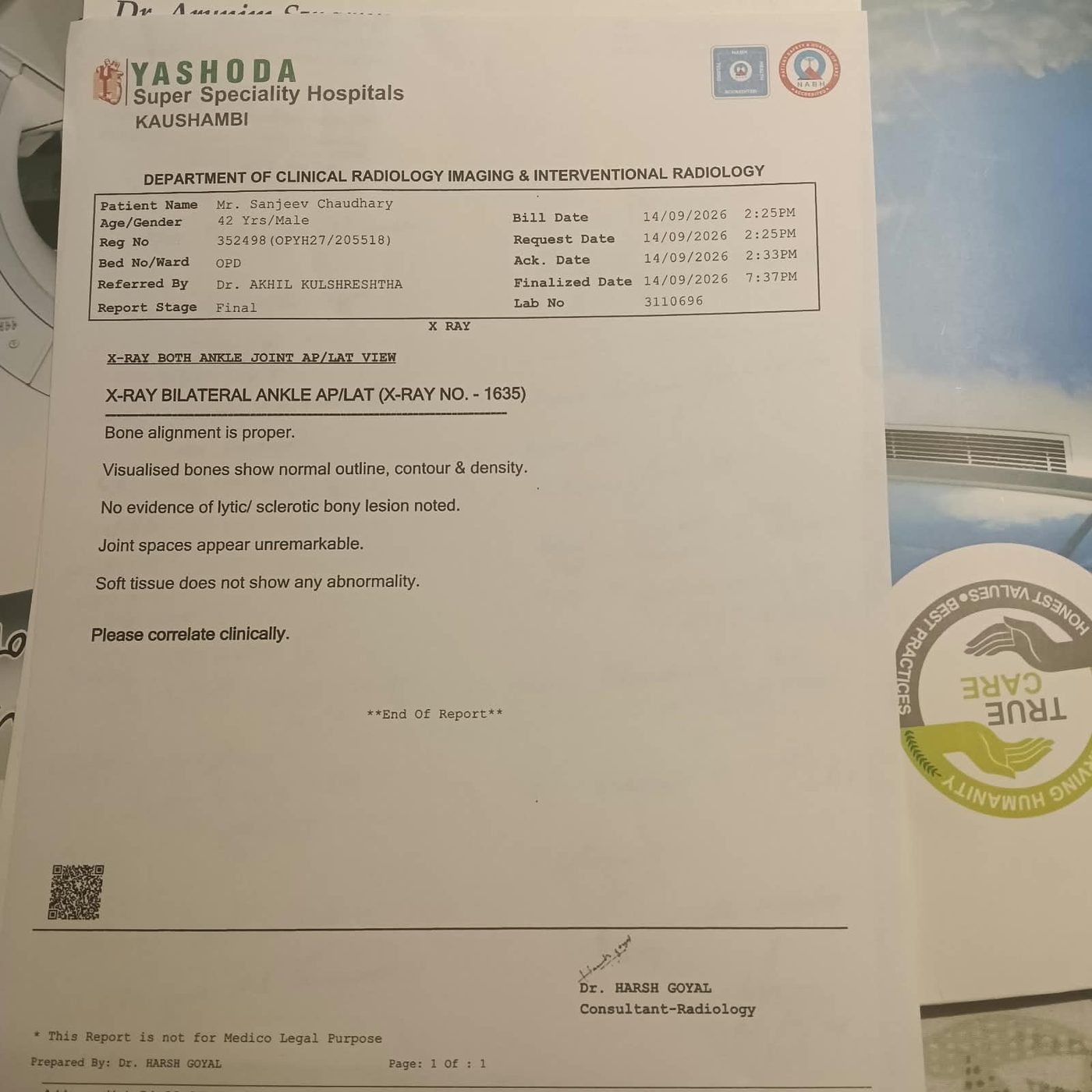 X-ray written report — Both ankles, Lab 3110696